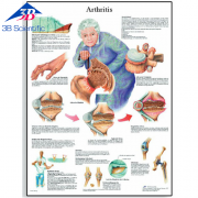 관절염 차트 Arthritis Chart VR1123L