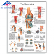 무릎 관절 차트 Knee Joint Chart VR1174L