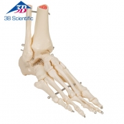 발 골격 관절 Foot and Ankle Skeleton A31 / 철사로고정 / Item: 1019357 [A31]
